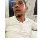 Ustaz Habib Abdul Hakim Jadi Korban Penganiayaan di Bekasi, Pelaku Diproses Polisi